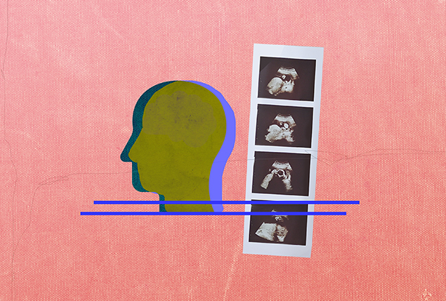 A block color profile of a head faces left and images from an ultrasound are next to it on the right.