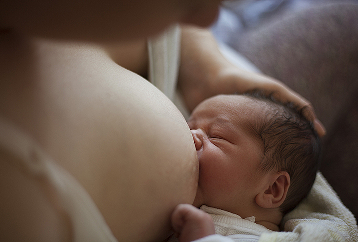 Breastfeeding After Breast Augmentation - Ardo: Supporting Pregnancy,  Birth, & Breastfeeding