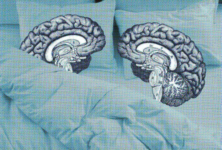 Two brains lying in bed with their frontal lobes facing one another.