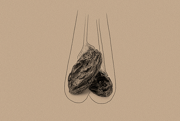 mumps testicular atrophy