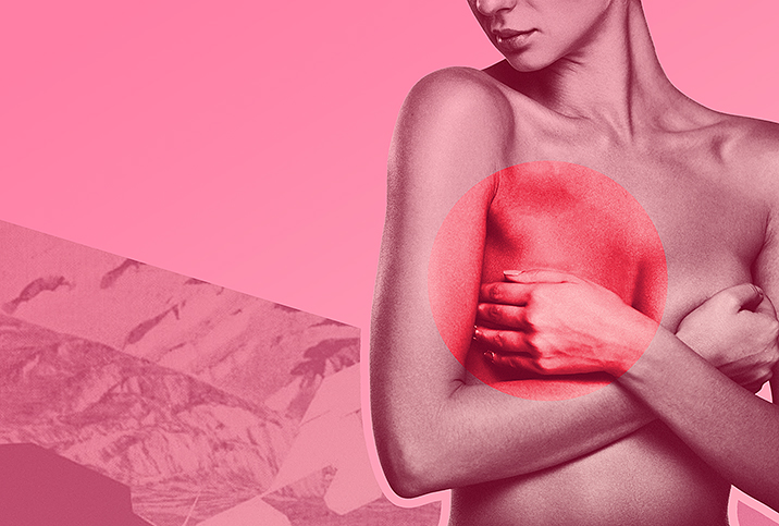 Minimizing Breast Cancer Scarring: Survivors Share What Worked for