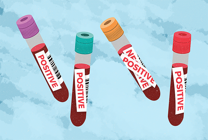 Four false positive chlamydia test vials.