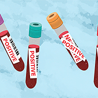 Four false positive chlamydia test vials.