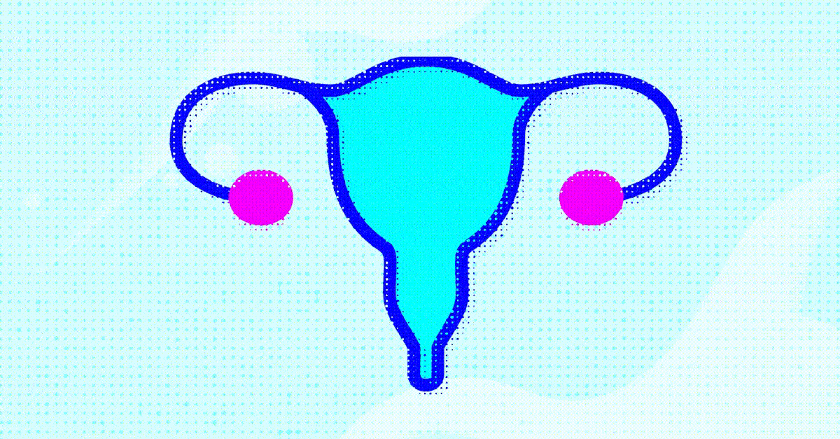 What You Should Know About This Rare Fertility Treatment Side Effect
