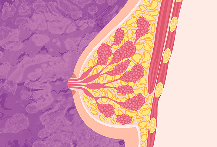 Are Your Nipples Sad?: A Discussion of Sad Nipple Syndrome