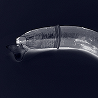 A black background features an X-Rayed banana wearing a condom.