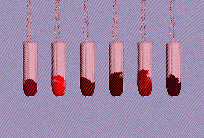 What Your Period Blood Consistency Could Be Telling You