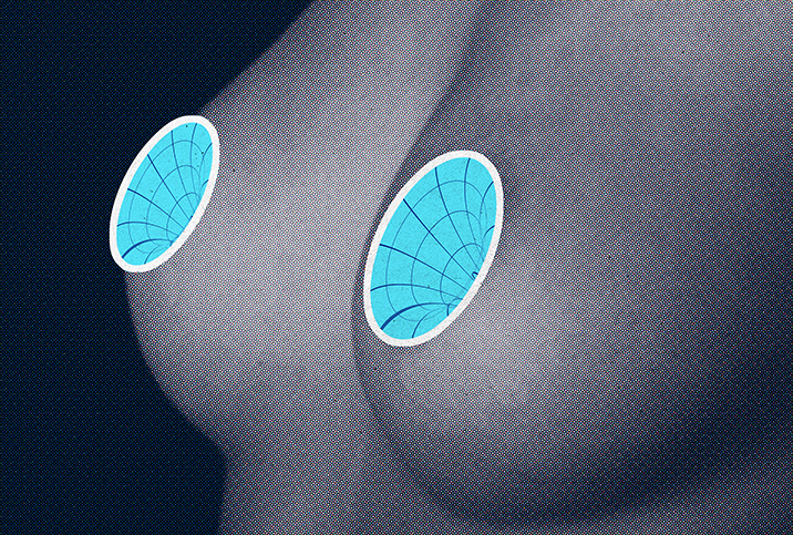 Sad Nipple Syndrome' Is All Over TikTok. But Is It A Real Thing