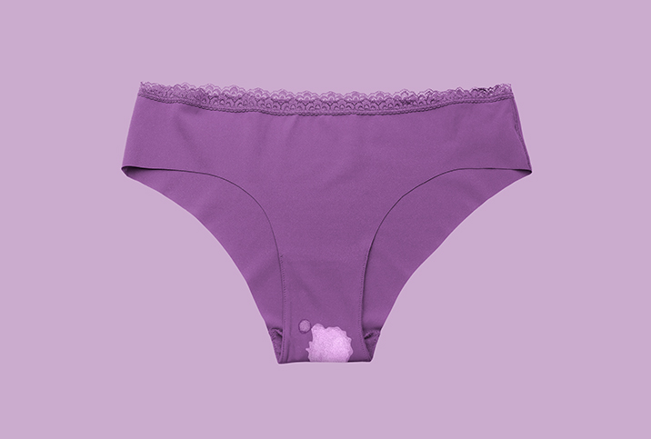 Help! Why Was My Underwear Bleached by Discharge?