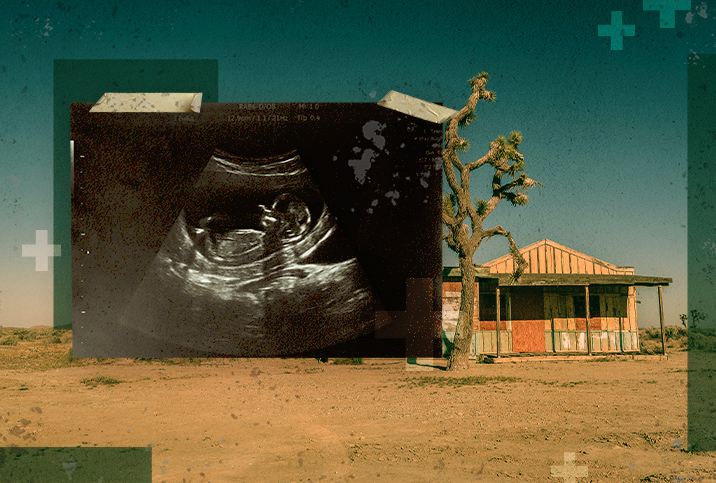 A large ultrasound of a fetus stands upright in the middle of a desert landscape.