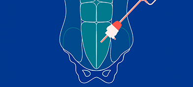 An outline of a male body from shoulders to pelvis has a robotic arm reaching towards the testicle area.