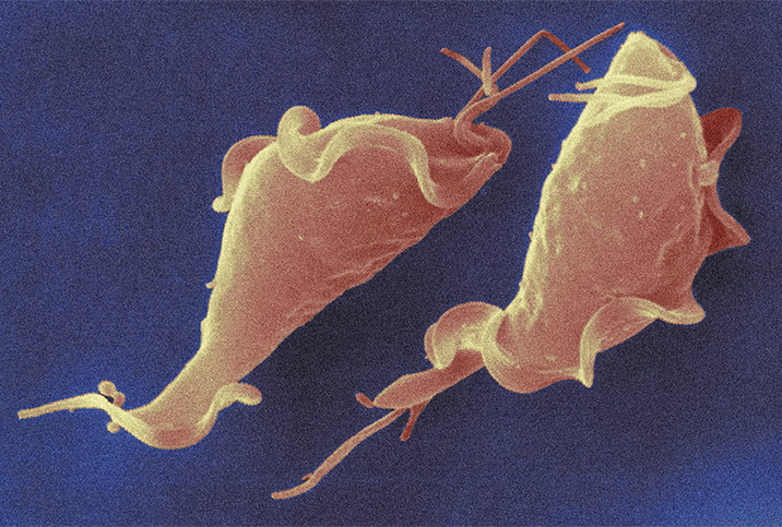 Trichomoniasis bacteria in orange lay against a blue background.