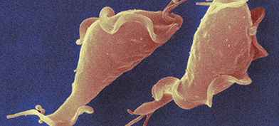 Trichomoniasis bacteria in orange lay against a blue background.
