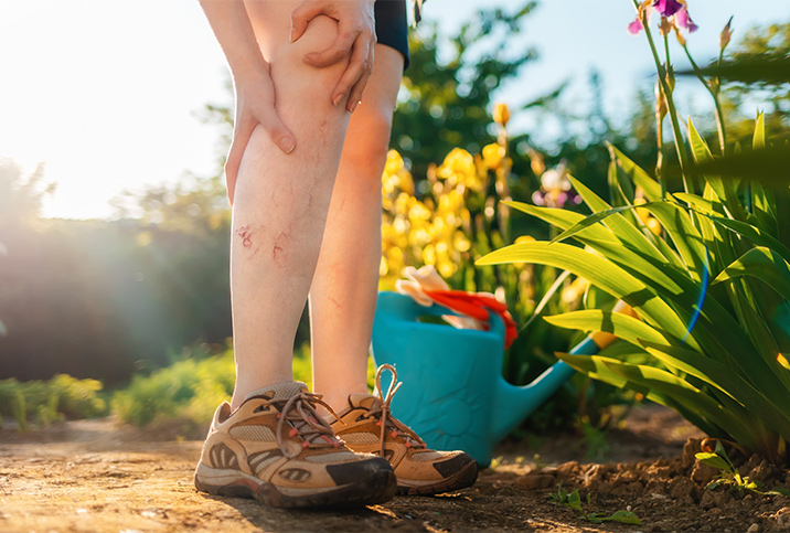 A woman standing in their garden is holding their knee and their calf in pain from deep vein thrombosis.