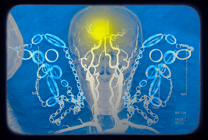 An x-ray of a human skull is surrounded by links and has a yellow spot in the brain.