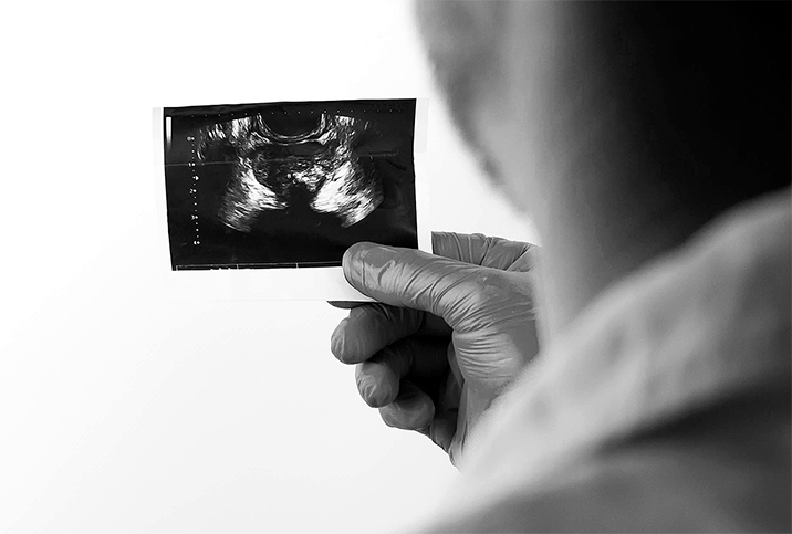 A doctor looks at an x-ray of a prostate.