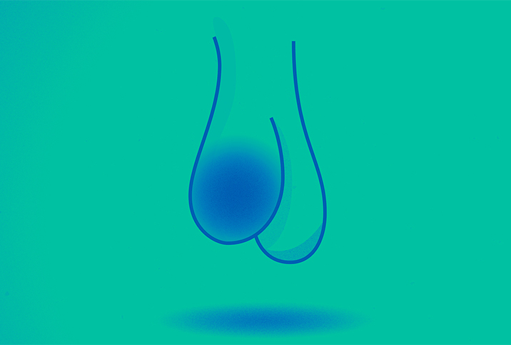 A blue outline of a penis and testicles sits against a green background with one testicle having a large blue tumor.