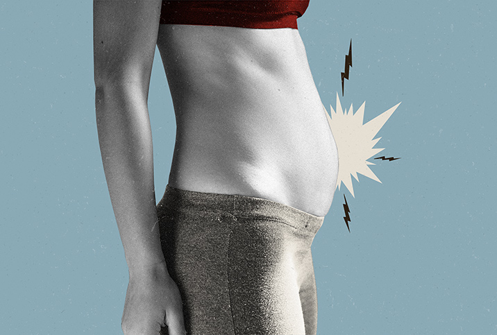 Bloating and Pelvic Floor Dysfunction