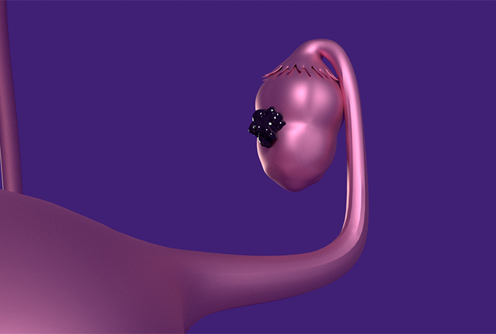 A plastic, purple ovary grows dark cells.