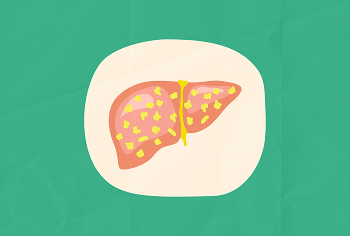 A liver with yellow fat spots sits on a cream colored plate and a green background.