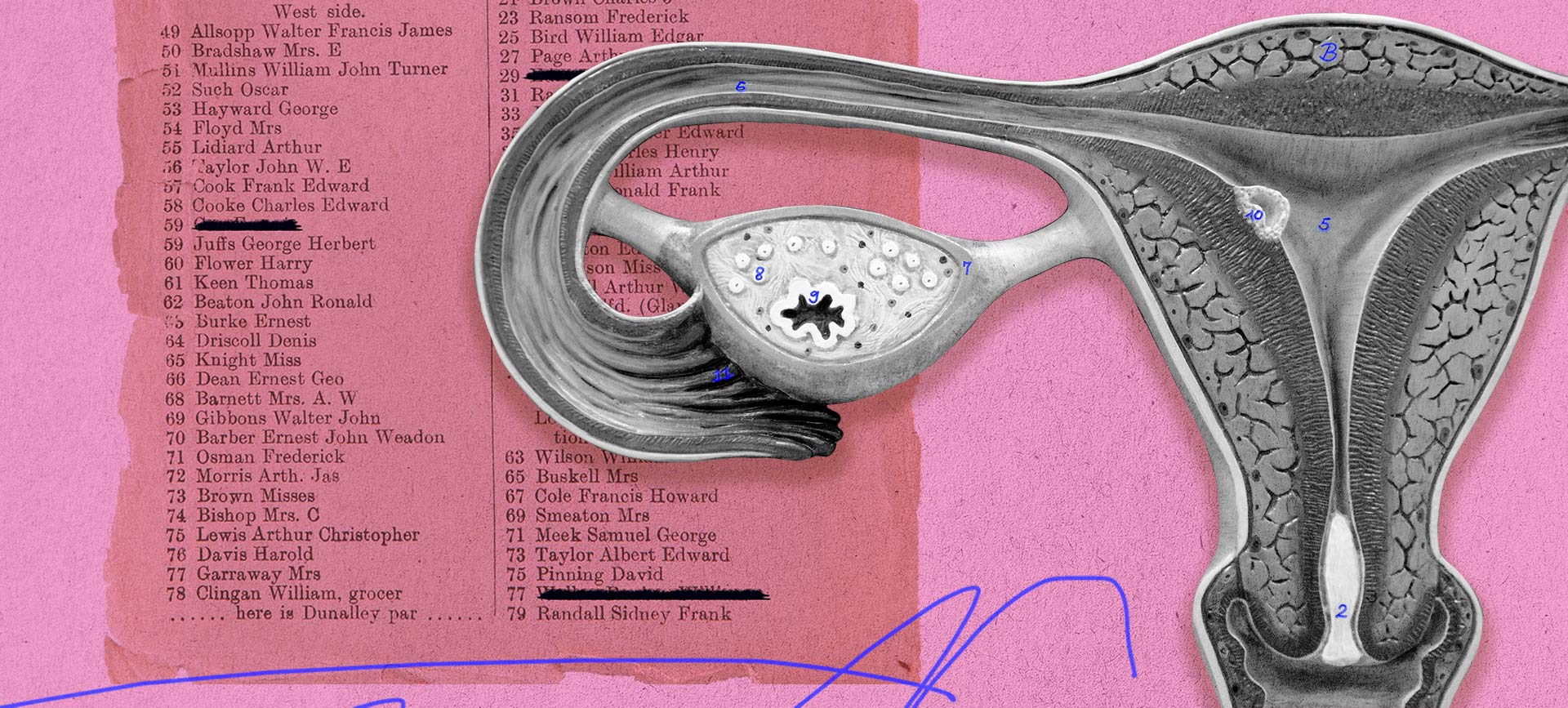 A map of the female uterus is outlined with numbers at different parts with a pink textbook page behind it.
