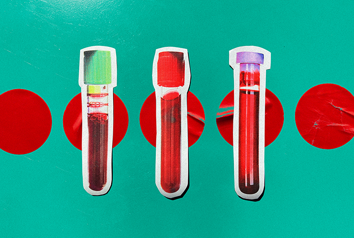 Three vials of blood with different caps are on top of a teal background with red circles.