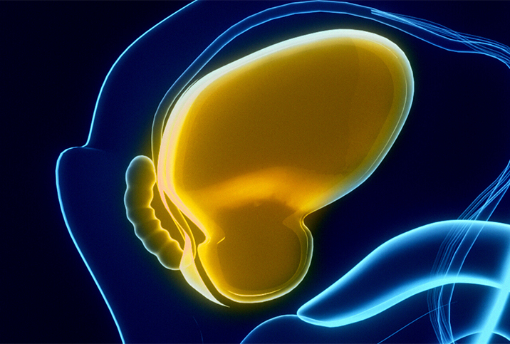 A yellow, stylized bladder sits within yellow, iridescent lines that swirl around it.
