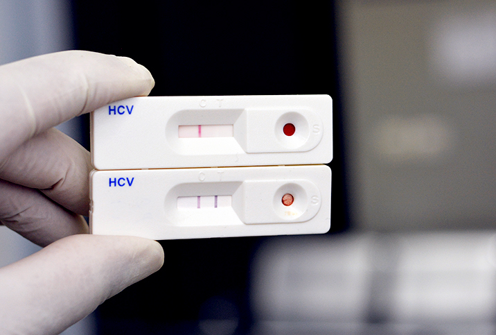 A positive test for Hepatitis C is held up together with a negative test.
