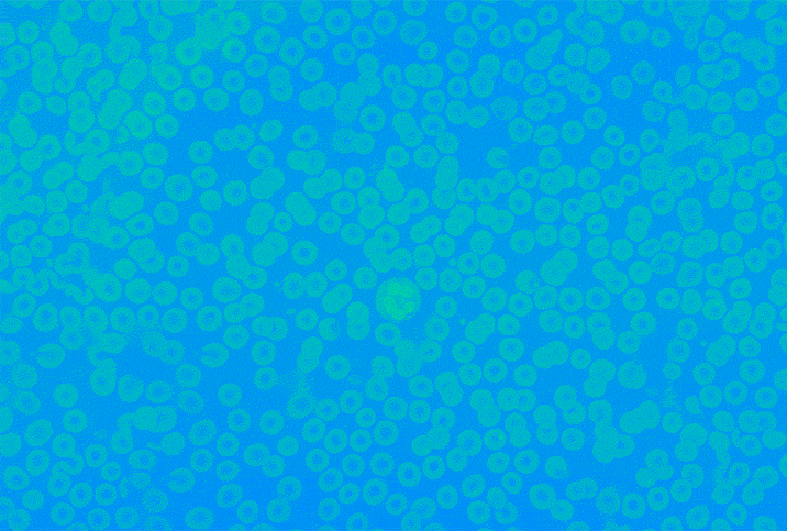 Green cells sit against a blue background and disappear into the background with only a blue ITP cell remaining.