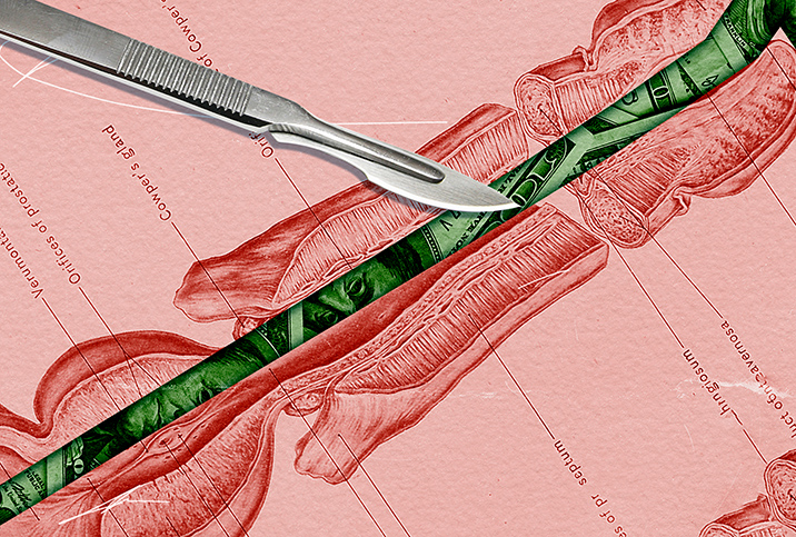 A diagrammed cross section of a penis has green money in place of the vas deferens and a scalpel lying across the image..