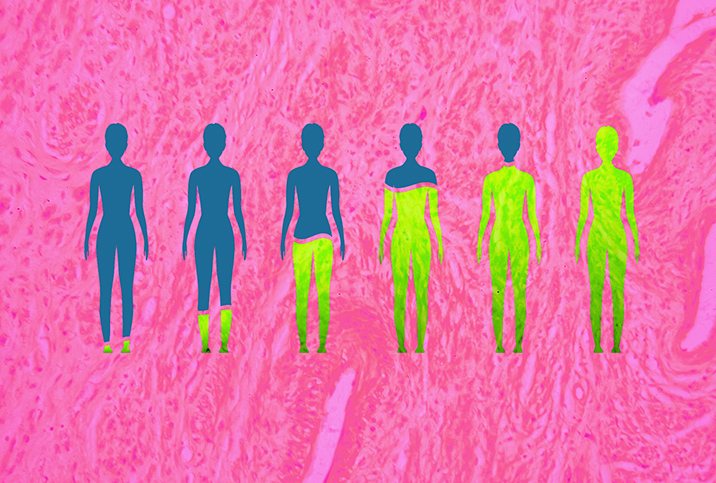 Six blue bodies in a row are filled gradually with yellow against a pink background.