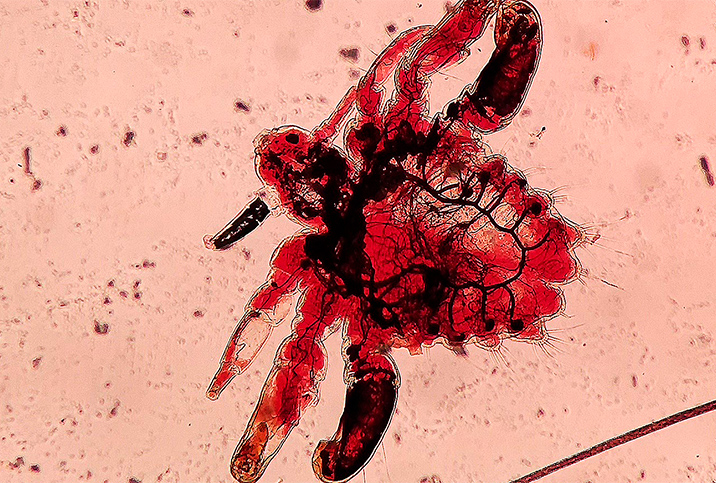 A red pubic lice is shown under a microscopic view.