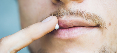 A man is putting white ointment onto his lips.
