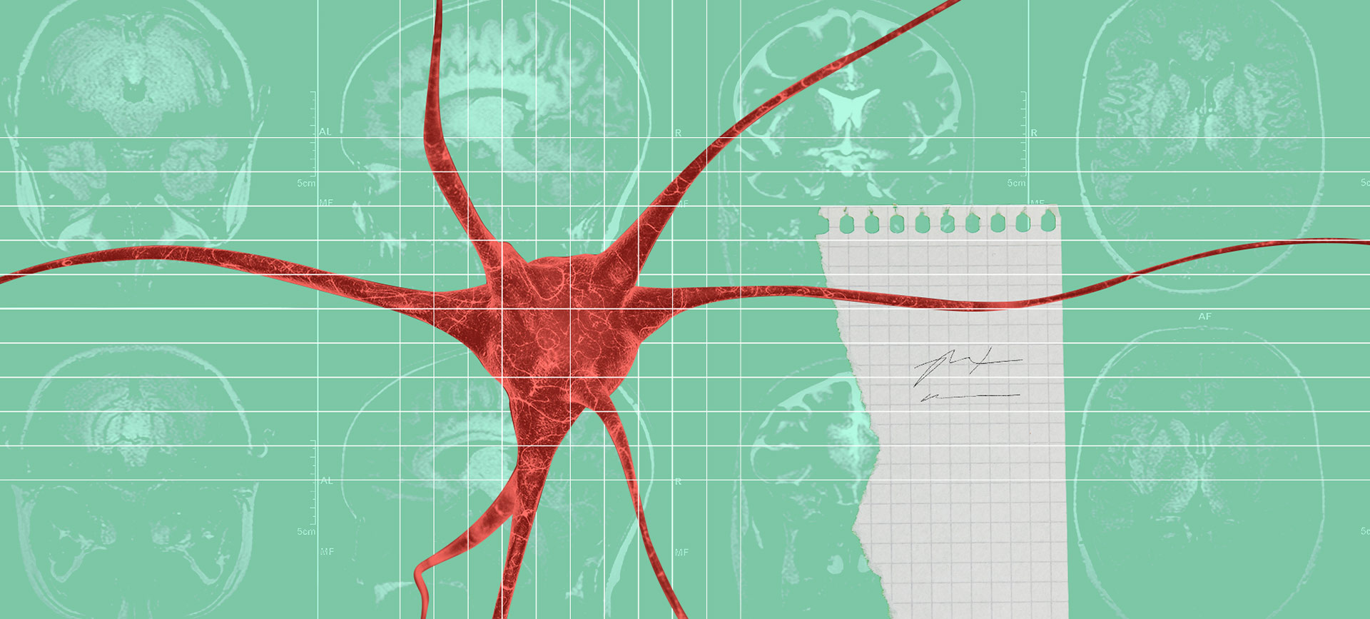 A red neuron layers over multiple green brain x-rays with a piece of graph paper beside it.