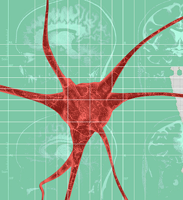 A red neuron layers over multiple green brain x-rays with a piece of graph paper beside it.
