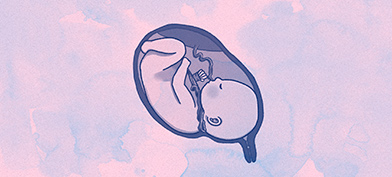On a pink and blue cloudy background an upside down baby is curled in a uterus with the umbilical chord wrapped around its neck.