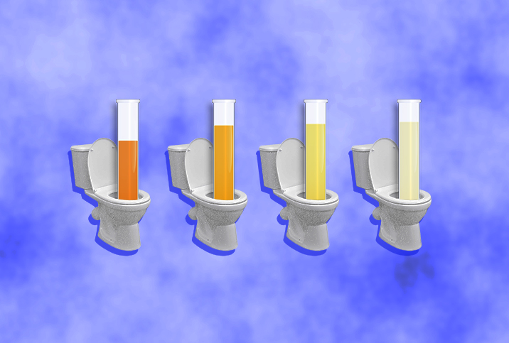 Four test tubes of urine in various stages of cloudiness stand inside of four toilet bowls.
