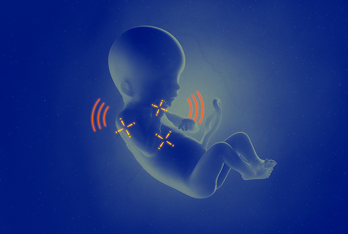 Three yellow crosshairs target over a blue fetus as red sound symbols surround it.