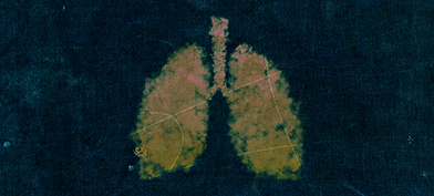 Two watercolor-painted lungs are in yellow and surrounded by navy blue.