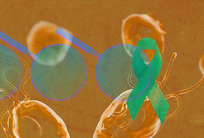 A blue magnifying looks over a yellow-orange prostate with a green cancer ribbon on it.