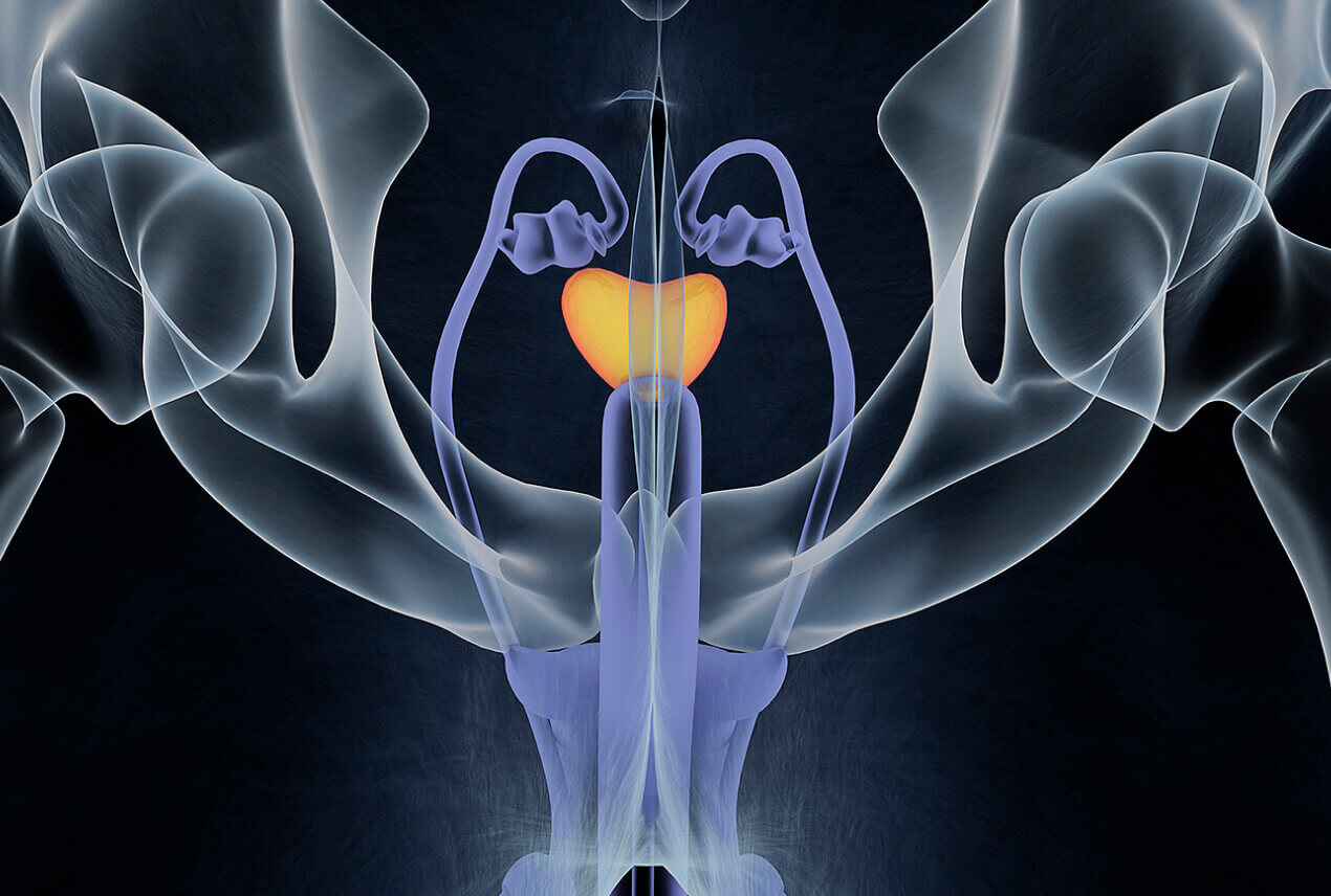 An x-ray of a male body shows an enlarged prostate.