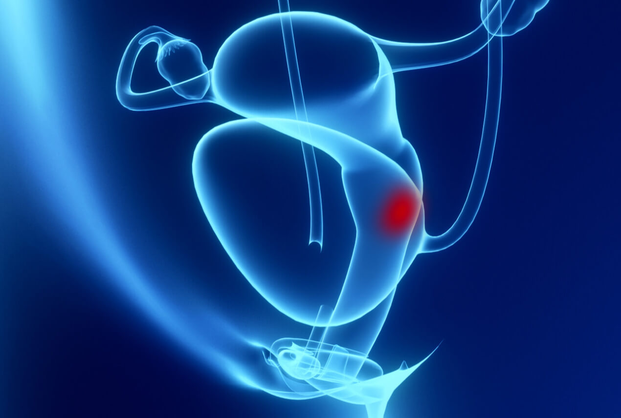 A neon blue 3D outline of the female reproductive system highlights the cervix with a red, glowing spot.