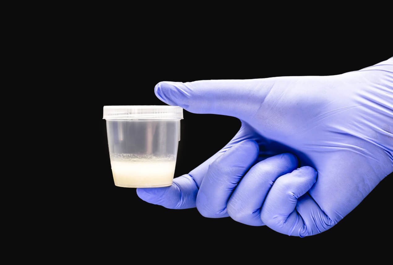 A gloved hand holds a little cup of semen.
