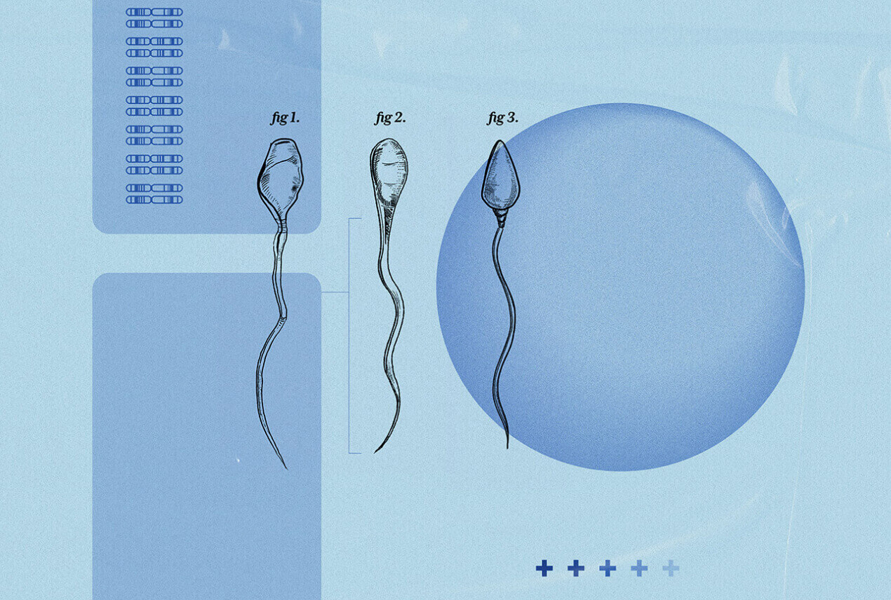 Three sperm are drawn next to a pitri dish.