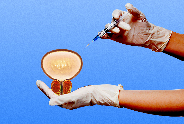 A hand holds an oversized prostate as the other hand uses a needle to inject medicine into it.