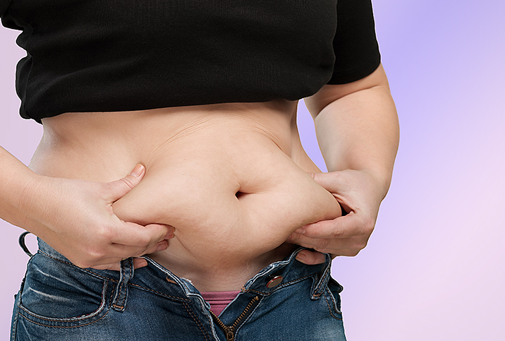A person holds the skin of their stomach after bariatric weight loss surgery.