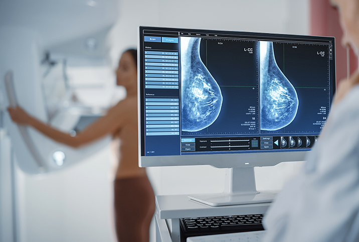 A person in the background is in a mammogram machine while a doctor in the foreground views the results on a screen.