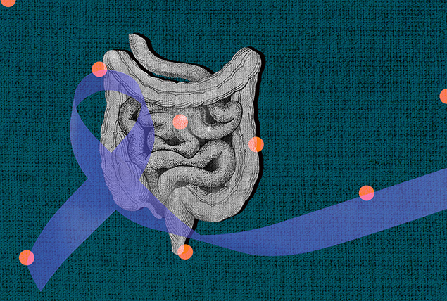 A blue cancer ribbon overlaps the grey drawing of a intestinal system.