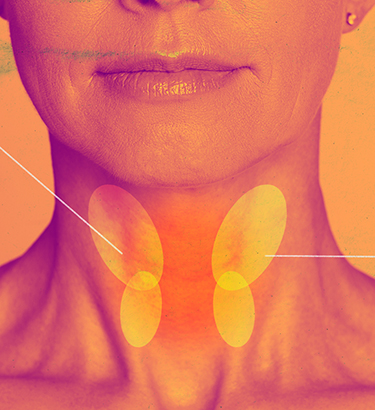 Two yellow ovals highlight each side of the thyroid on the outside of the neck.