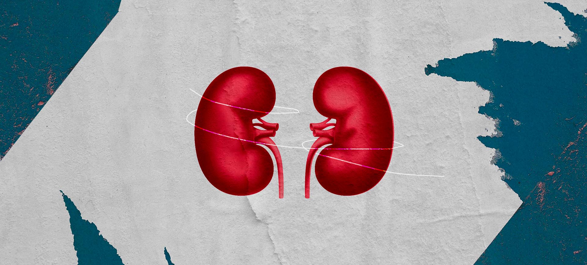 A red kidney is mirrored against a grey and dark green background.